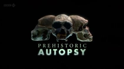 Prehistoric Autopsy